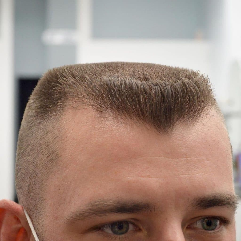 Reference image for The Flat Top.